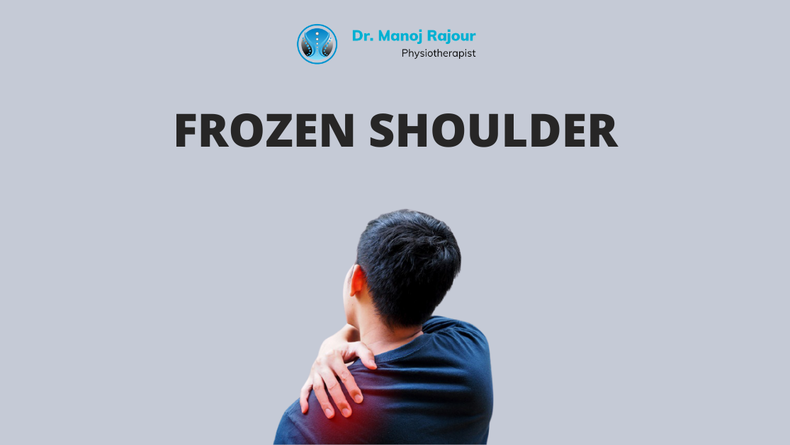 FROZEN SHOULDER