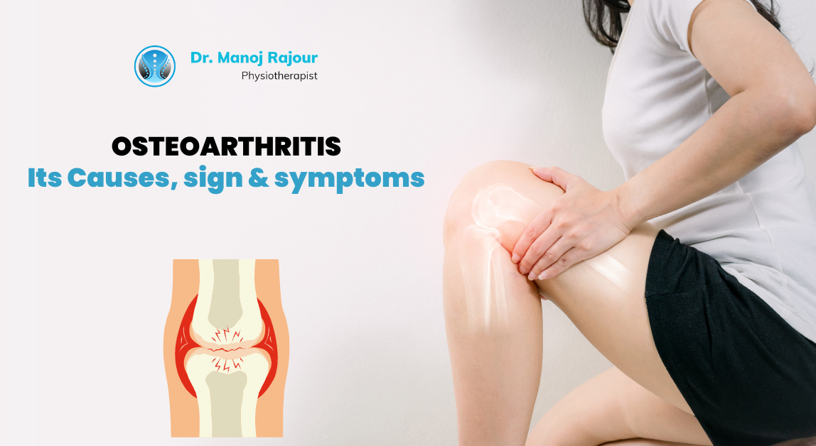 OSTEOARTHRITIS – Its Causes, sign & symptoms