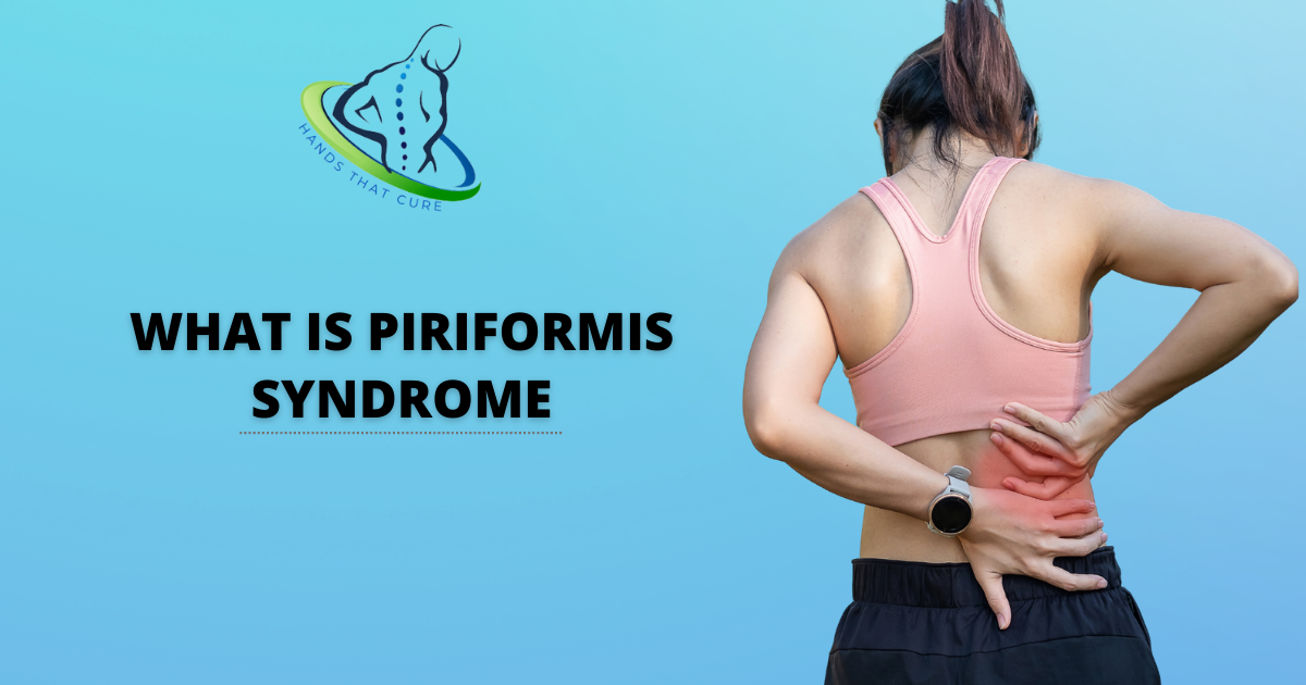 PIRIFORMIS SYNDROME