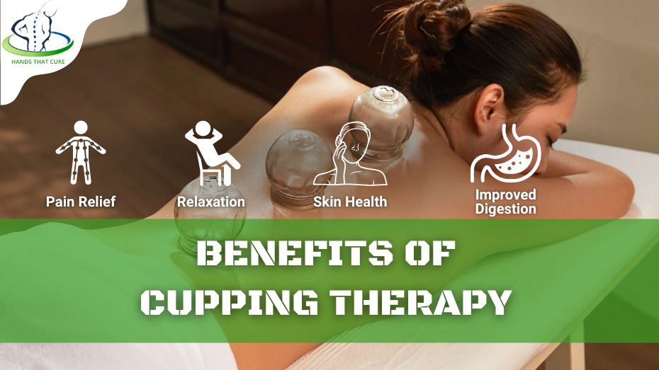 Benefits of Cupping Therapy